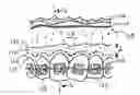 Fig. 01 - Systems and methods for orthodontic treatments