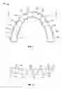 Fig. 02 - Dental appliance