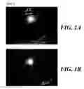 Fig. 02 - Use of a human amniotic membrane composition for prophylaxis and treatment of diseases and conditions of the eye and skin