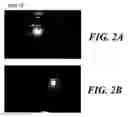 Fig. 03 - Use of a human amniotic membrane composition for prophylaxis and treatment of diseases and conditions of the eye and skin