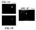 Fig. 04 - Use of a human amniotic membrane composition for prophylaxis and treatment of diseases and conditions of the eye and skin