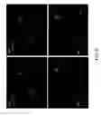 Fig. 07 - Methods of identifying small molecules for renewal, survival and migration of cardiac progenitors