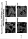 Fig. 22 - NOVEL GERMINAL KINASE PROTEINS, COMPOSITIONS AND METHODS OF USE
