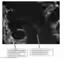 Fig. 01 - METHODS FOR DIAGNOSING CHRONIC DIARRHEA