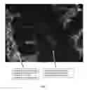 Fig. 02 - METHODS FOR DIAGNOSING CHRONIC DIARRHEA