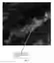Fig. 06 - METHODS FOR DIAGNOSING CHRONIC DIARRHEA