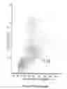 Fig. 158 - Novel Classification Method of Blood Cells and Tailor-Made Therapy and Prevention Based Thereupon