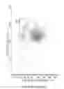 Fig. 294 - Novel Classification Method of Blood Cells and Tailor-Made Therapy and Prevention Based Thereupon