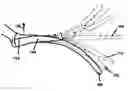 Fig. 01 - Methods for creating large scale focused blade deflections