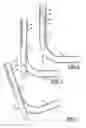 Fig. 03 - Athletic Goal Assembly