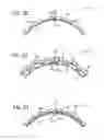 Fig. 20 - Game ball optimally positioned grooves and/or ridges