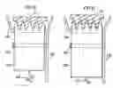 Fig. 07 - Vibration Compensating Pulley