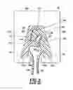 Fig. 03 - Methods for sensing features on moving fastener tape during automated production