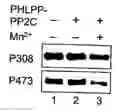 Fig. 01 - Compositions and Methods for Treating Diseases Associated With Phlpp