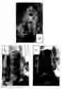 Fig. 01 - Cartilage regeneration promoting agent