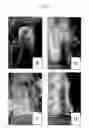 Fig. 06 - Cartilage regeneration promoting agent