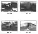 Fig. 09 - METHODS OF PROMOTING OSTEOGENESIS