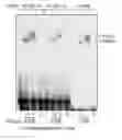 Fig. 01 - NUCLEOTIDE SEQUENCE ASSOCIATED WITH ACUTE CORONARY SYNDROME AND MORTALITY