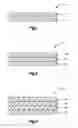 Fig. 02 - Ionomer pigmentation