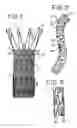 Fig. 02 - Medical Devices Incorporating a Bioactive and Methods of Preparing Such Devices