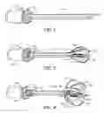 Fig. 02 - Expandable brachytherapy device with constant radiation source spacing