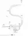 Fig. 02 - VACUUM STABILIZED OVERTUBE FOR ENDOSCOPIC SURGERY