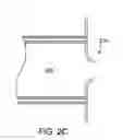 Fig. 04 - VACUUM STABILIZED OVERTUBE FOR ENDOSCOPIC SURGERY