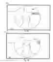 Fig. 04 - System and method for the automated zooming of a surgical camera