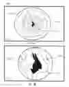 Fig. 06 - System and method for the automated zooming of a surgical camera