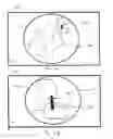 Fig. 07 - System and method for the automated zooming of a surgical camera