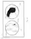 Fig. 08 - System and method for the automated zooming of a surgical camera