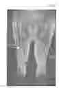 Fig. 01 - System and method for automated alignment of leg volumes in whole-body magnetic resonance scans