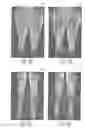 Fig. 09 - System and method for automated alignment of leg volumes in whole-body magnetic resonance scans