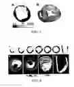 Fig. 04 - Methods and Systems of Analyzing Clinical Parameters and Methods of Producing Visual Images