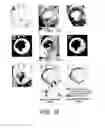 Fig. 16 - Methods and Systems of Analyzing Clinical Parameters and Methods of Producing Visual Images