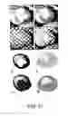 Fig. 17 - Methods and Systems of Analyzing Clinical Parameters and Methods of Producing Visual Images