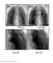 Fig. 08 - METHOD AND SYSTEM FOR DEFINING AT LEAST ONE ACQUISITION AND PROCESSING PARAMETER IN A TOMOSYNTHESIS SYSTEM