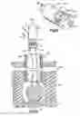 Fig. 10 - Method for joining implants