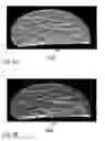 Fig. 06 - METHOD FOR PRODUCING MODEL OF FIBROUS STRUCTURE OF FIBROUS TISSUE