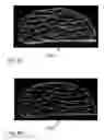 Fig. 07 - METHOD FOR PRODUCING MODEL OF FIBROUS STRUCTURE OF FIBROUS TISSUE