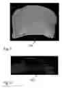 Fig. 09 - METHOD FOR PRODUCING MODEL OF FIBROUS STRUCTURE OF FIBROUS TISSUE