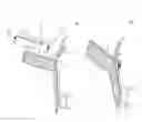 Fig. 02 - Massage Device