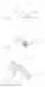 Fig. 09 - Catheter with associated extension lumen