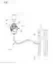 Fig. 02 - Vascular access device gas displacement