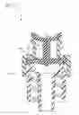 Fig. 08 - Vascular access device gas displacement