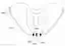 Fig. 01 - Device and method for less invasive surgical stabilization of pelvic fractures