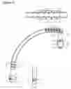 Fig. 05 - Device and method for less invasive surgical stabilization of pelvic fractures