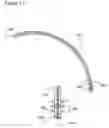 Fig. 10 - Device and method for less invasive surgical stabilization of pelvic fractures