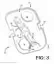Fig. 03 - Mounting devices for fixation devices and insertion instruments used therewith