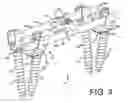 Fig. 04 - Mounting devices for fixation devices and insertion instruments used therewith